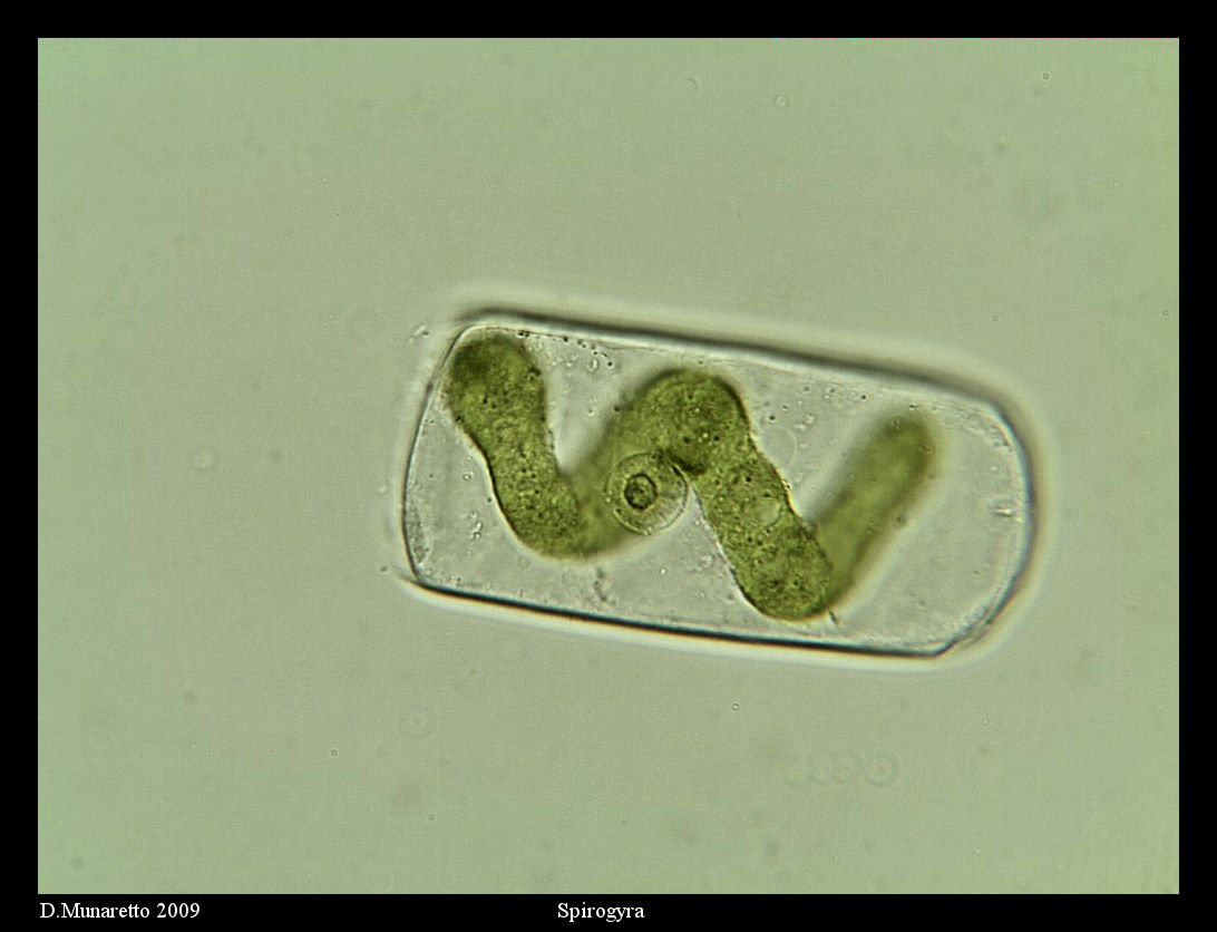 Spirogyra...?